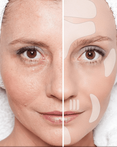 Silicone Anti-wrinkle Face Patch